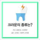 골드플러스치과의원 네이버블로그