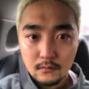 스마일약국 | [강남 ㅎㄴ안과] 뉴스마일라식 수술 3달 후기ㅣ고도근시&amp;중증도난시 👀
