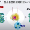 교모세포종,두경부암의 중성자 붕소 암 표적 치료(BNCT, Boron Neutron Capture Therapy) 이미지