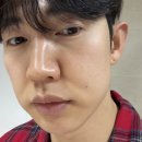 헤어오율