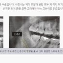 고운치과의원 네이버블로그