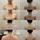 상무지구 신부관리 승모근관리 해윤에서 예식 준비한 후기