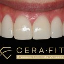 세라치과기공소 이미지