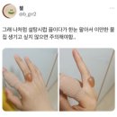 요즘 탕후루 덕분에 먹고 산다는 화상 전문병원 이미지