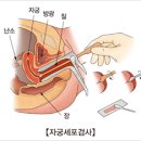 이화산부인과 네이버블로그