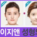 이지성형외과 이미지