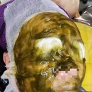 오투O2피부관리