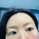스킨벨 | 강남역 피부과 모공스킨부스터 쥬베룩+스킨보톡스 받은 후기!(가격,통증,효과)