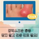 류마잘보는내과의원 | 인천 옹진 통풍 잘보는곳 왜 류마티스내과일까요?