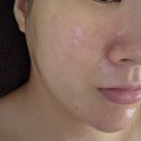 신중동역 피부관리 코코스킨앤바디 부천본점 트러블 진정관리 후기(4번째 방문)