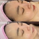올가드림뷰티 송파위례점에서 모공 디톡스 진정관리받은 후기
