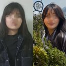 브이모텔 | 사각턱 수술 내돈내산 후기: 긴곡선 붓기, 통증, 처짐 8년차 솔직정리 (귀뒤 사각턱)