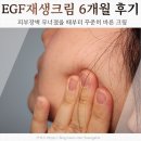바른온누리약국 | 피부장벽 붕괴 경험 후 선택한 지피덤 EGF재생크림 6개월 후기