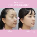 바이미성형외과의원 이미지