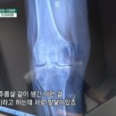 소나무정형외과의원 네이버블로그