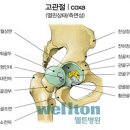 밤잠 못이루게 괴로운 고관절통증 !! 원인과 증상을 알고 치료해보아요 ^ㅡ^ 이미지