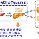 간이 안좋을때 알콜성 간 지방간 간염 간부전 술 끊으면 이미지