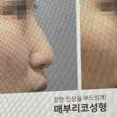 뉴원성형외과의원 이미지