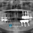 스마일홍치과의원 이미지
