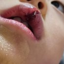 서초 서울 마더스 이미지