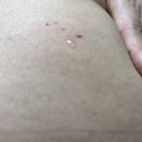 수정-3 | 인공수정 3차 후기｜배란유도 중 장어즙, 흑마늘? (병원 답변)