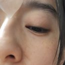 클리어 스킨케어