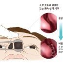 참부부한의원 네이버블로그