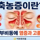 수지한의원 | [수지 축농증한의원] 치료 후기, 축농증(부비동염) 증상과 원인, 방치하면 위험한 이유