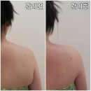 폴라리스 | 잠실새내 피부관리 폴라리스 에스테틱 바디슬리밍 솔직 후기