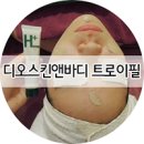 비비디오주 | 오돌토돌 피부가 트로이필 1회로 깨끗해졌어요! 당산동 피부관리 디오스킨앤바디 첫번째 후기!