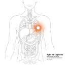 나도갈비 이미지