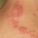 천궁헬스케어 이미지