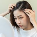 홍 헤어라인 이미지