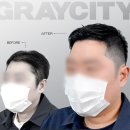 그레이시티 광주직영점 | 대전탈모 관리, 나만을 위한 프라이빗 케어: 그레이시티 대전직영점 후기