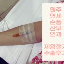 송정1차라인 | 원주 연세순풍산부인과 제왕절개 수술 후기