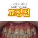 스마일블로썸치과의원 이미지