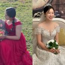 예신다이어트 팔 지방흡입 2달차 본식 드레스 핏 후기!