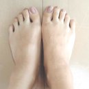 발가락으로 보는 건강 상식 이미지