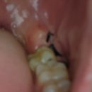 사랑니톡앤턱치과의원 이미지