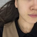 김한의원 | 목동 스킨부스터 세연한의원 플라좀 후기