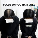 나는 소년이었다 SMP 이미지