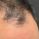 스칼프디자인센터 의정부점 이미지