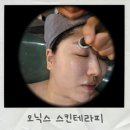 오닉스스킨테라피 | 왕십리 피부관리 오닉스 스킨테라피 올리고 리프팅 리얼후기
