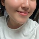 피부관리 | 압구정피부관리 이코르청담 피부관리 후기