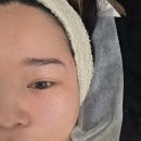이샵(전대점) | 광주 피부관리 전대미백관리는 프롬도트에서 해결하자