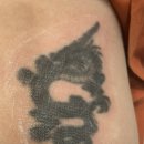 🧴 연세스타피부과 문신 제거 솔직 후기 (1~10회차 진행 상황 + 추가 계획) #내돈내산