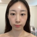 위너스뷰티 | 김해피부관리 빈스뷰티 슈퍼젝션 후기 색소 잡티 케어 재방문 솔직 후기