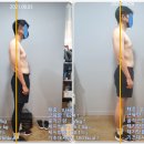 이천PT / 이천헬스 / 이천재활운동[YT트레이닝센터] 운동후기 Good case