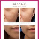 착한피부과 이미지