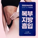 큐라인